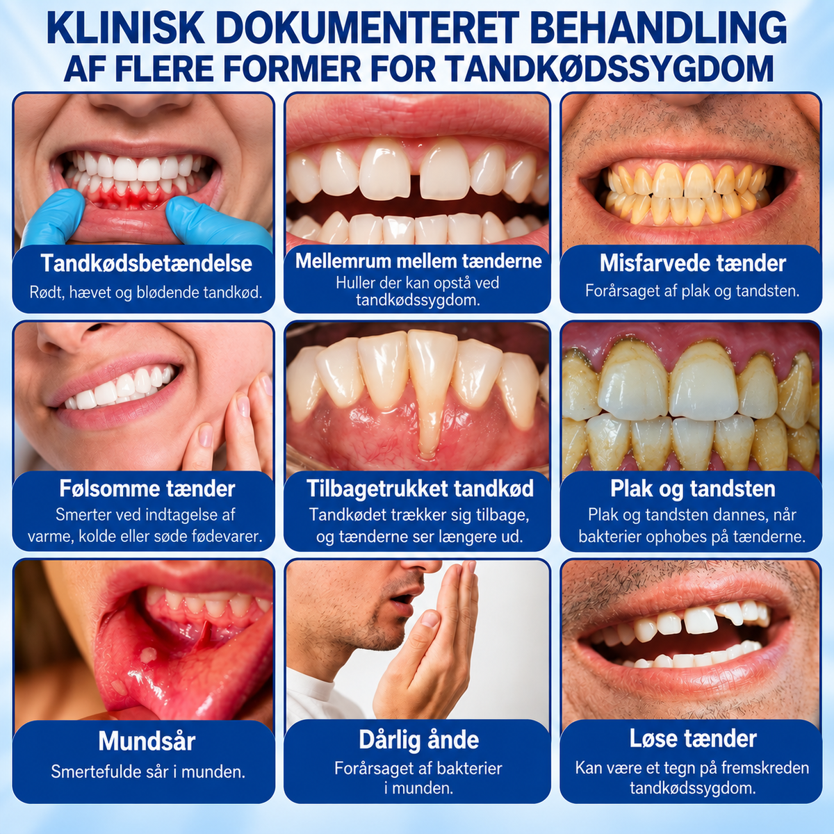 GumRevive™ | Gel til pleje af tandkødet
