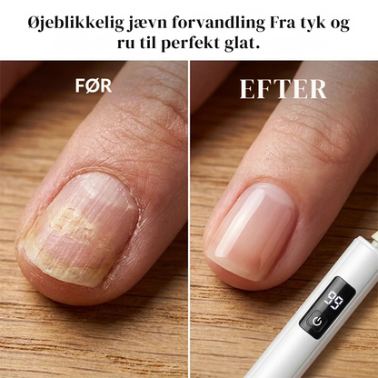 💅✨ 50 % RABAT! Professionel elektrisk neglefil – Gør det nemt at file og forme selv tykke negle. Med digitalt display, 99 hastighedsindstillinger og flere udskiftelige slibehoveder får du professionelle resultater – direkte hjemmefra! 🌟💎